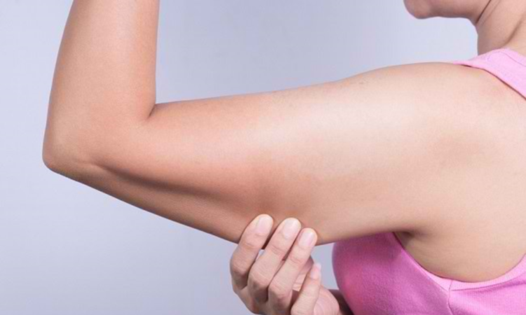 5 Cara Mengencangkan Lengan dengan Mudah dan Praktis
