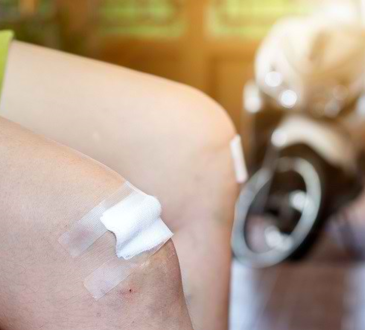 6 Langkah Mengobati Luka Jatuh dari Motor  