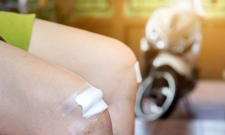 6 Langkah Mengobati Luka Jatuh dari Motor  